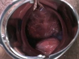 Senhora grávida japonês é examinado e suga lollicock accomplish médico